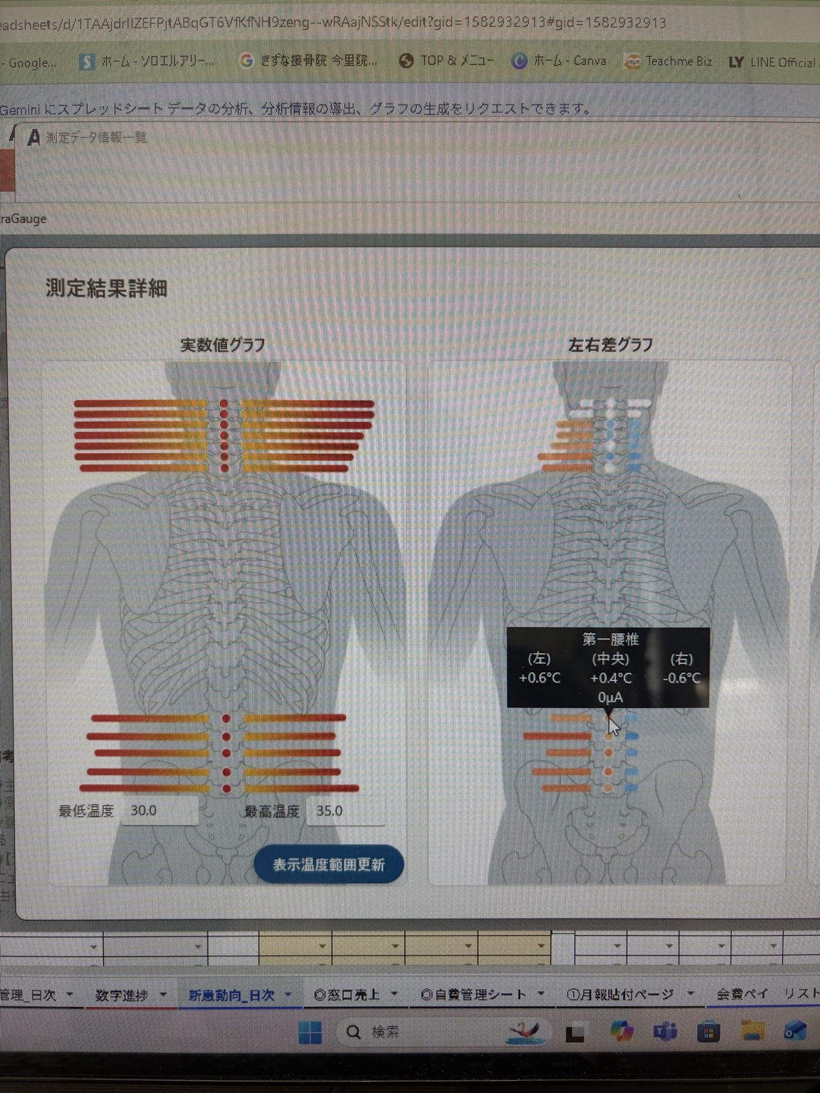 身体の測定結果をグラフで可視化した画面